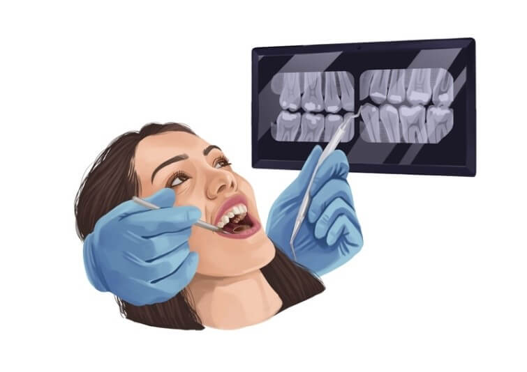 Importance of Dental Deep Cleaning