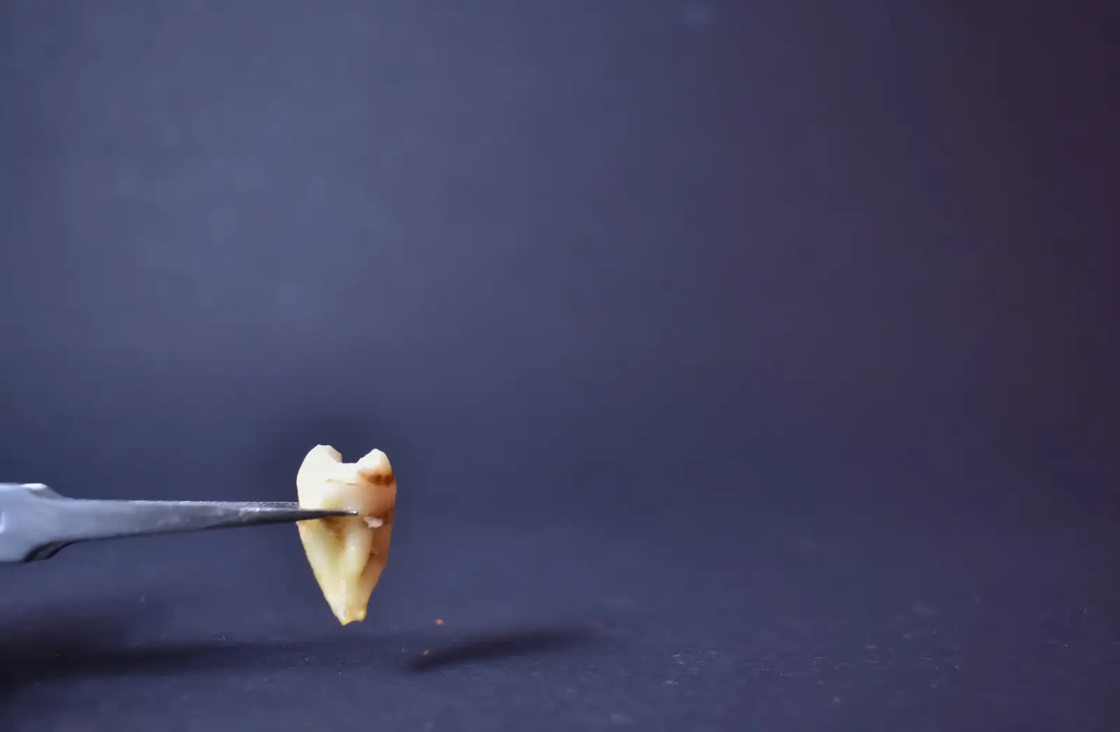 close up of fallen tooth