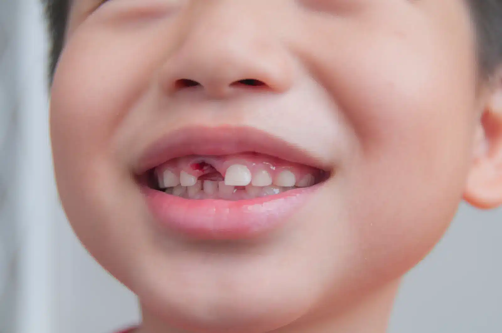 close up of missing tooth