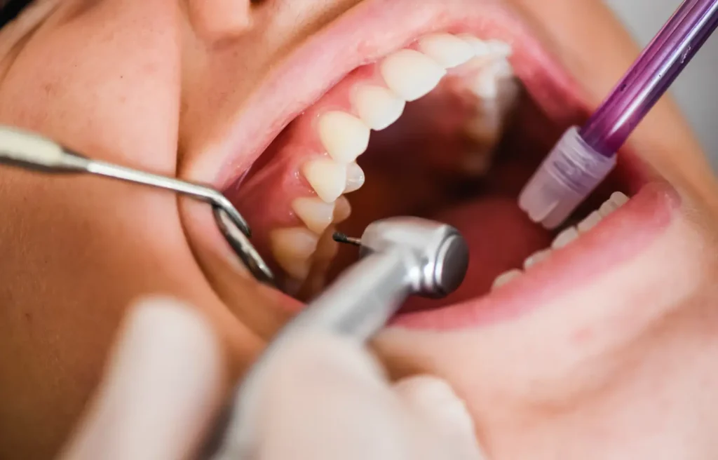 dental treatment brisbane