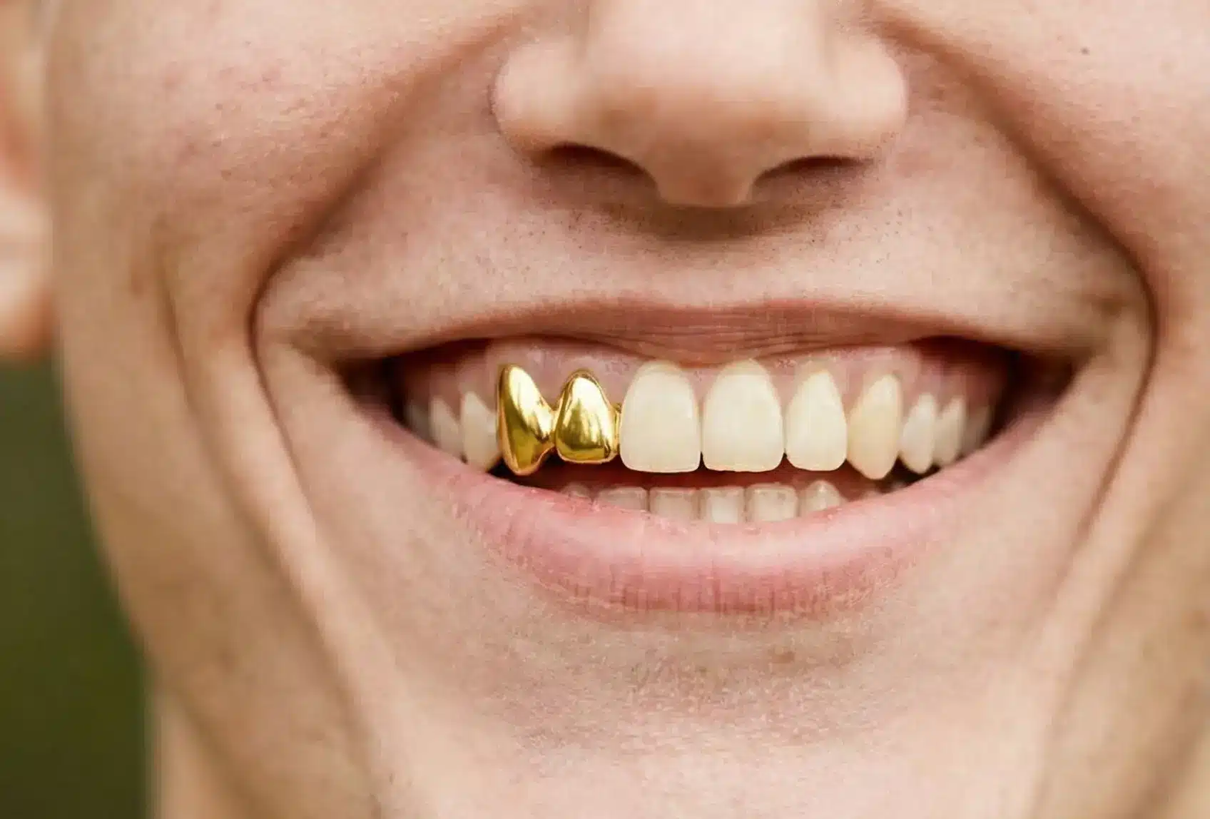 gold tooth