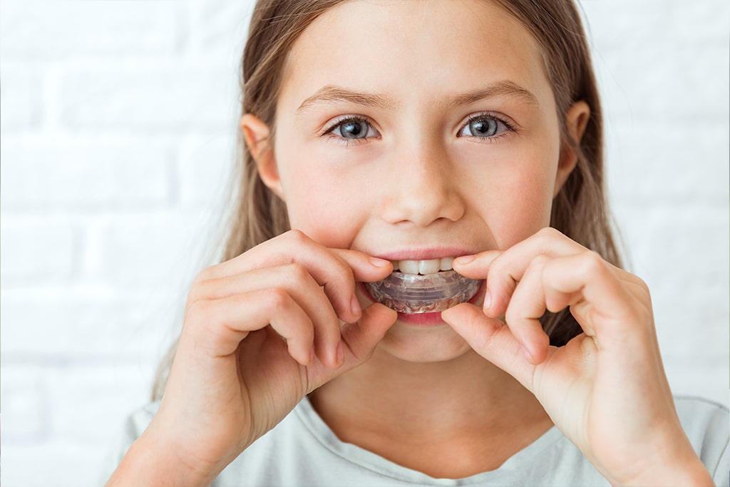 mouthguards for children