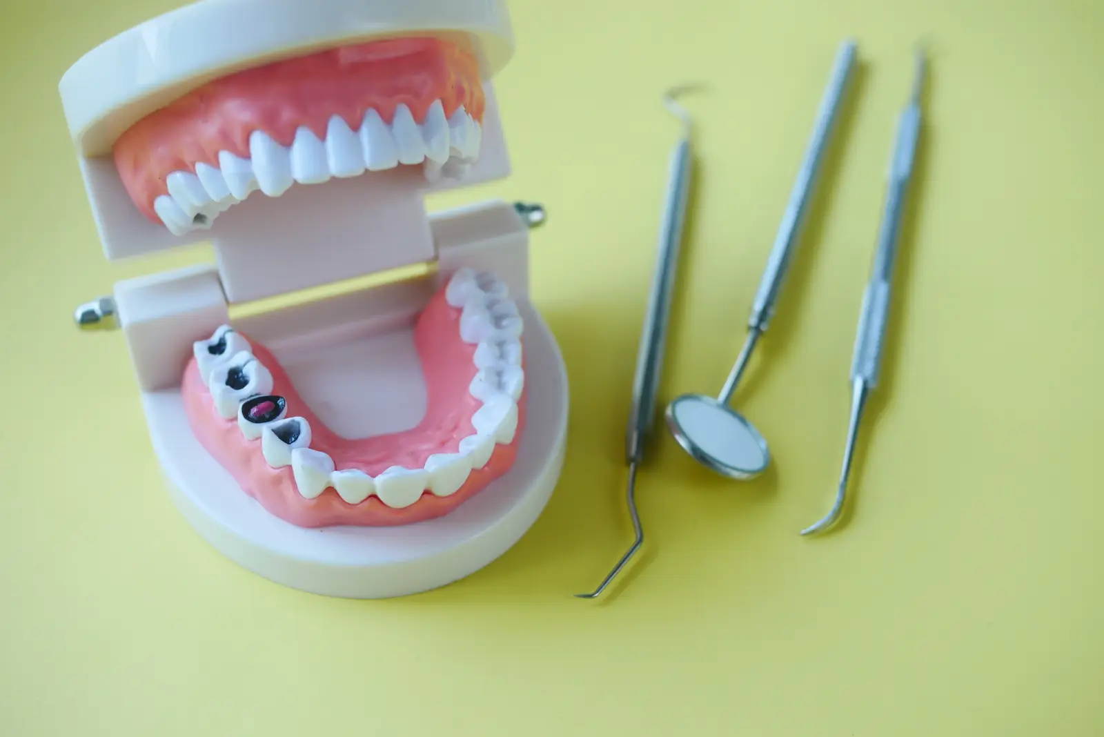 tooth coloured fillings