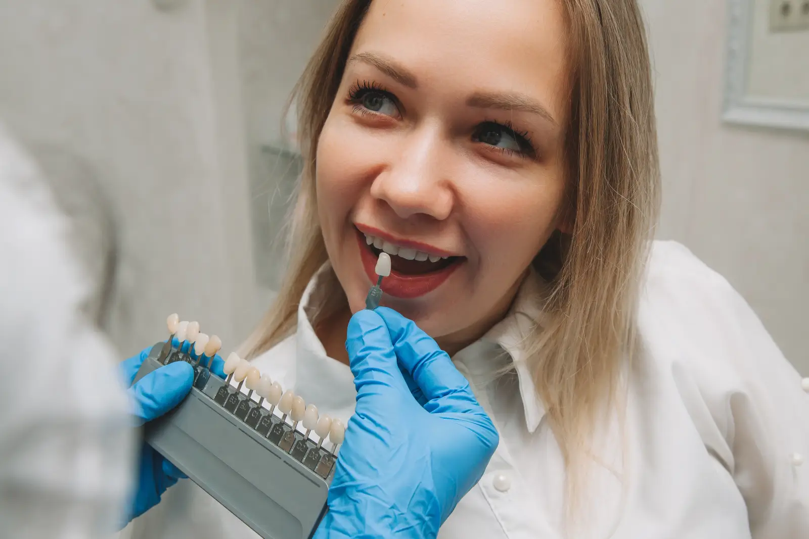 selecting correct tooth color