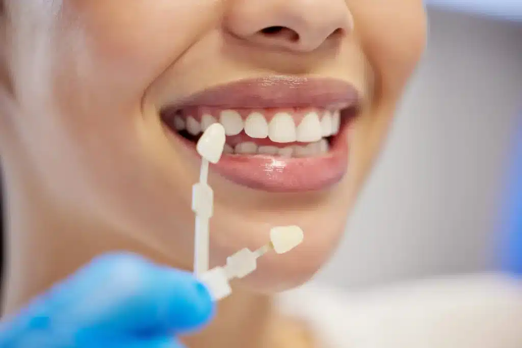 Smiling woman holding dental veneer samples, showcasing cosmetic dentistry options for smile enhancement.