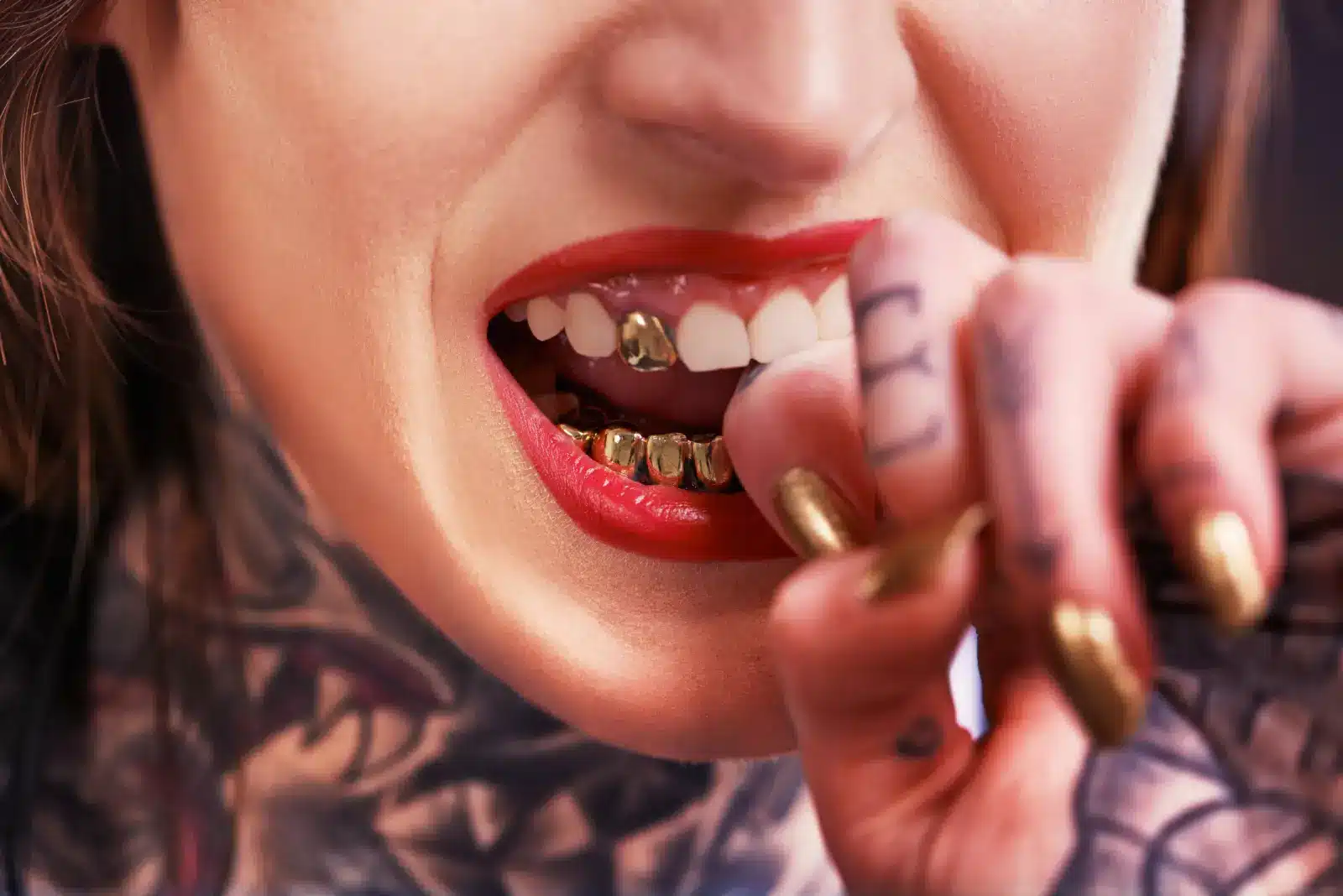 gold teeth