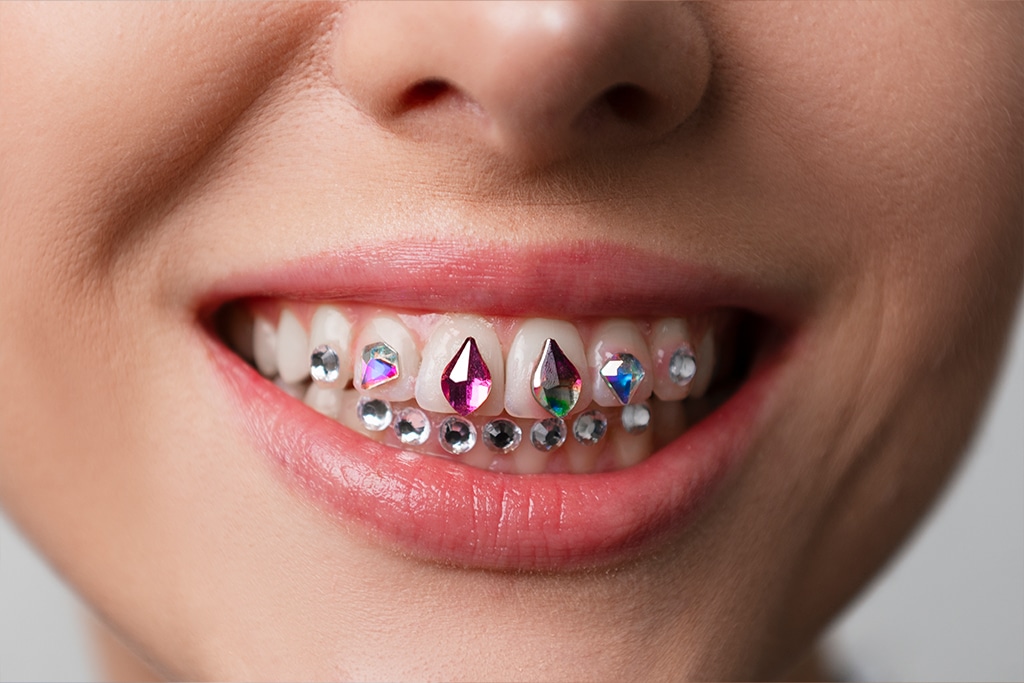 what is tooth jewellery