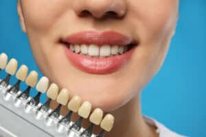 woman checking her teeth color on blue background to check if she has a problem of teeth discolouration