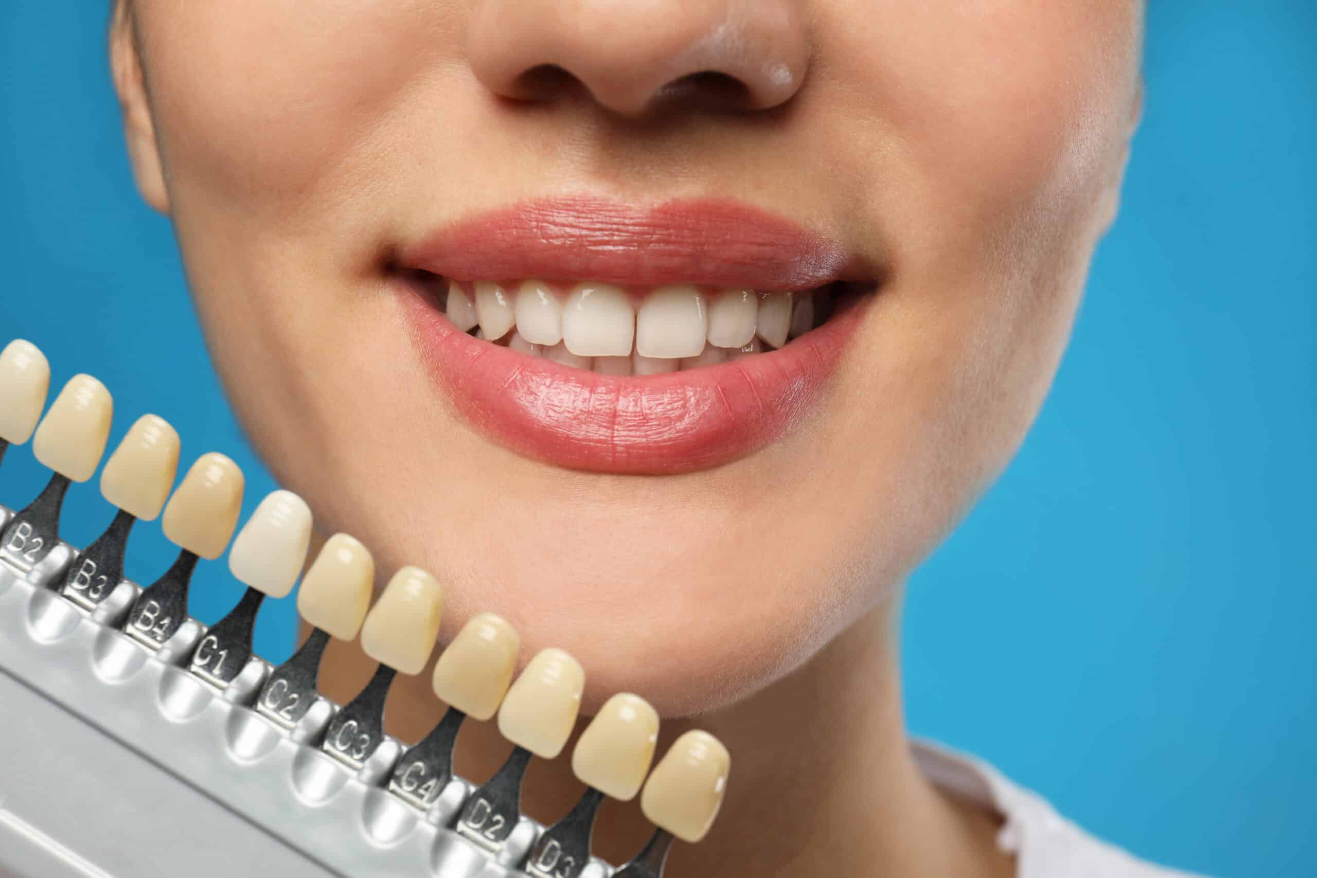 woman checking her teeth color on blue background to check if she has a problem of teeth discolouration