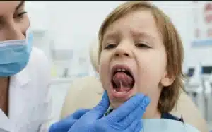 toungue tie checked in a kid