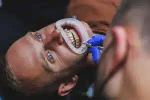 full mouth rehabilitation
