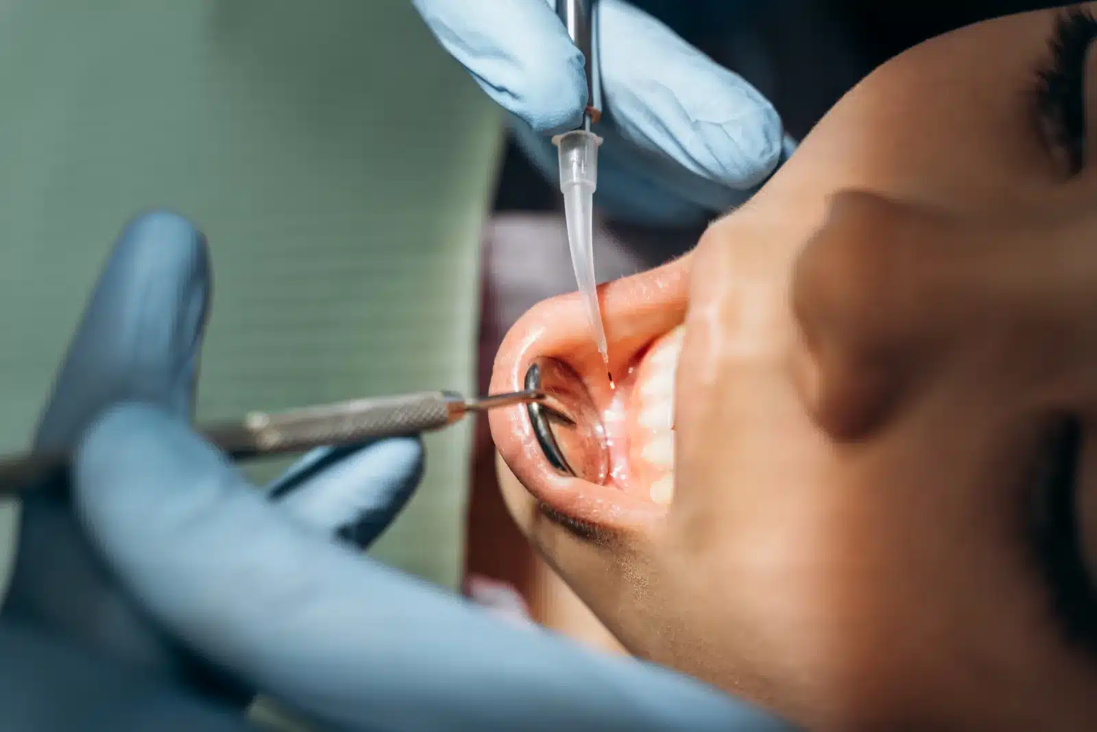 close up of gum therapy